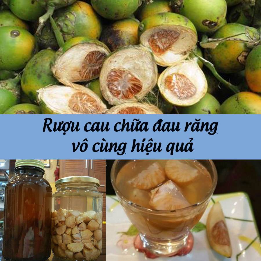 rượu cau trị sâu răng