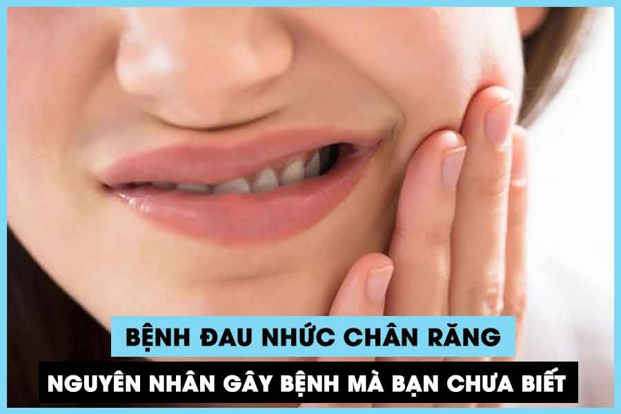 Bệnh đau nhức chân răng