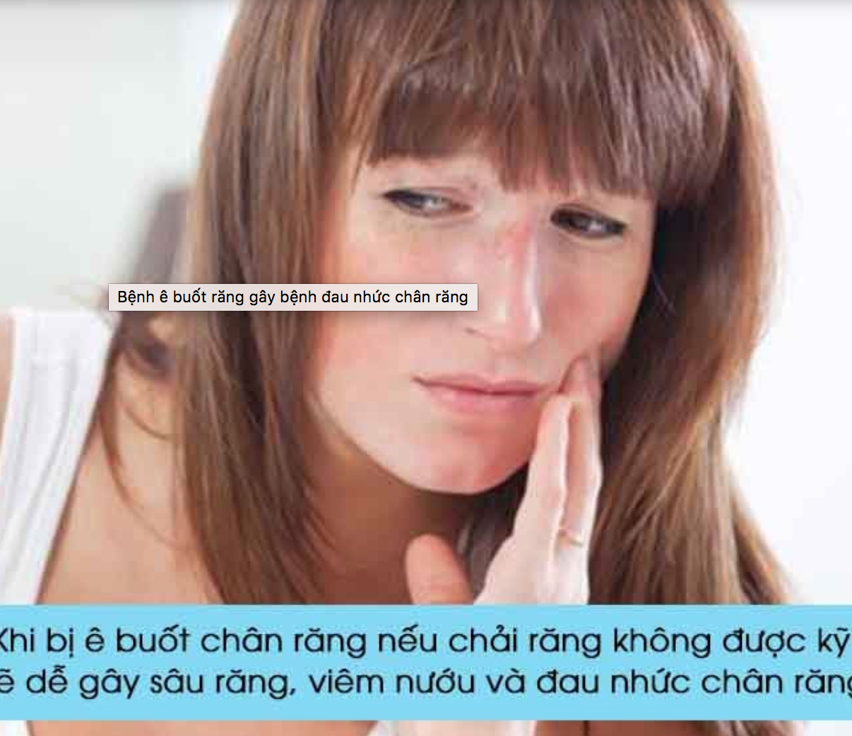 đau nhức răng do ê buốt
