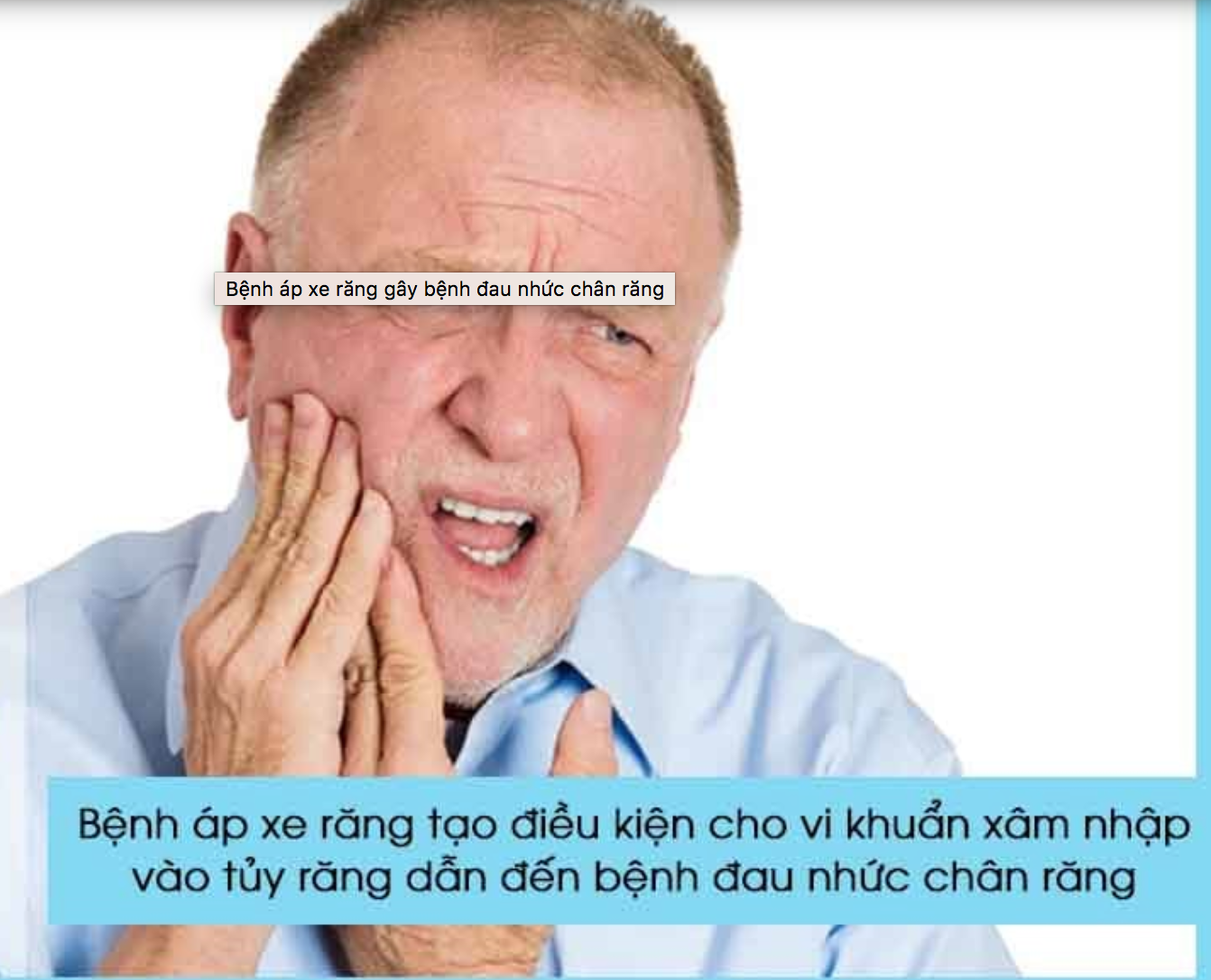 áp xe răng làm đau răng