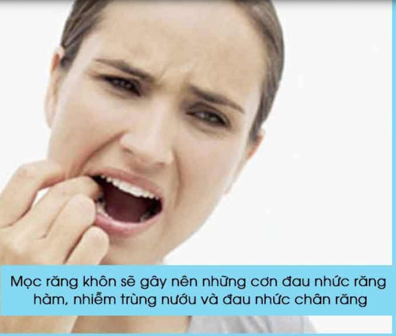 mọc răng khôn gây đau nhức