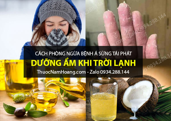 phòng bệnh á sừng sau sinh