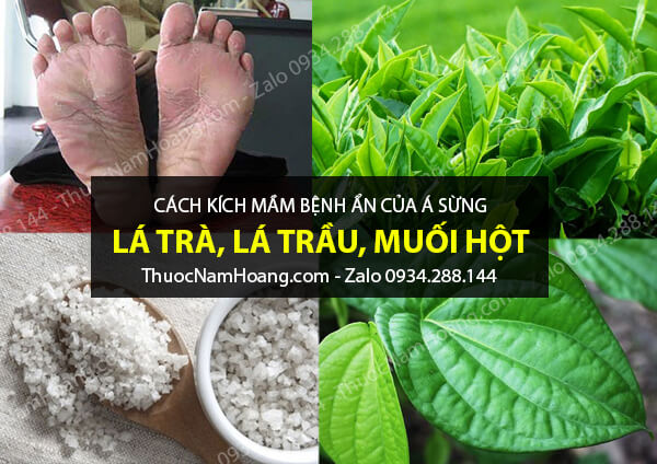 cách chữa bệnh á sừng cho bà bầu