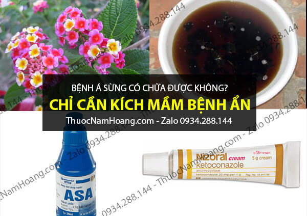bệnh á sừng ở tay có chữa được không
