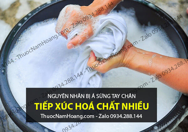 nguyên nhân bị á sừng ở tay chân