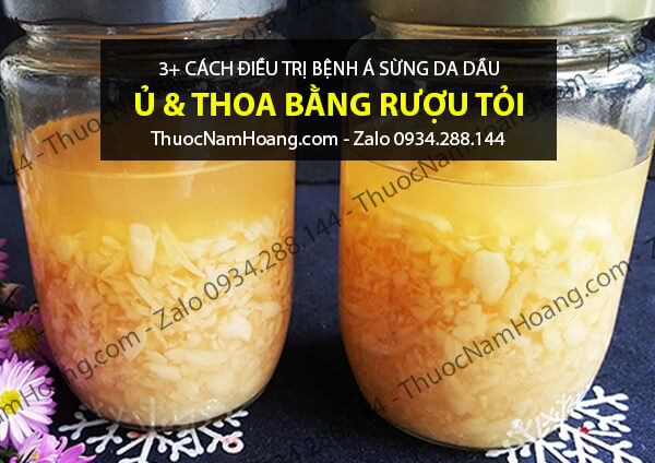 rượu tỏi trị bệnh á sừng vẩy nến da đầu