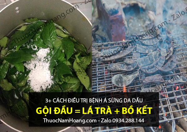 cách điều trị á sừng da đầu bằng lá trà xanh và bồ kết