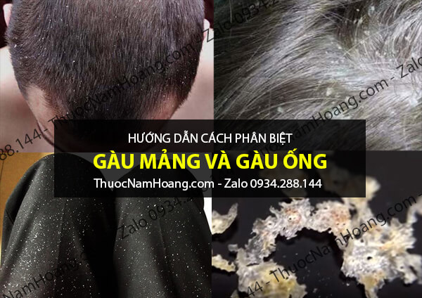 gáu mảng