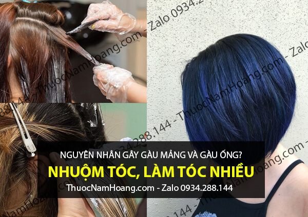nhuộm tóc gây gàu mảng
