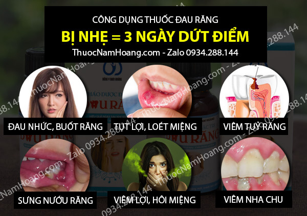 thuốc trị nhức răng khi mang thai