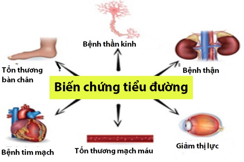 triệu chứng bệnh tiểu đường
