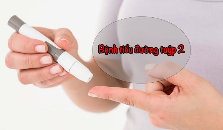 bệnh tiểu đường tuýt 2