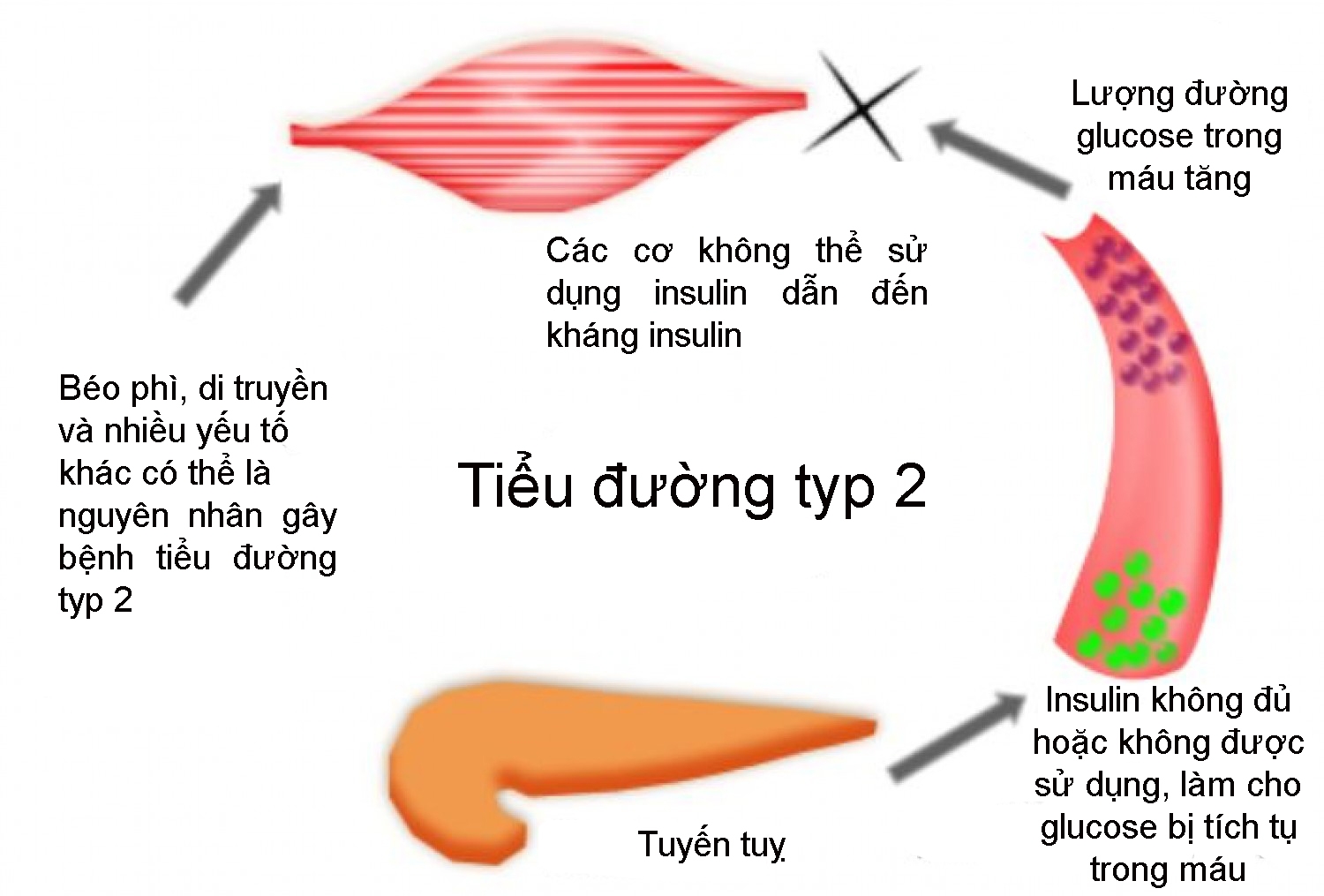 tiểu đường tuýt 2 có nguy hiểm không