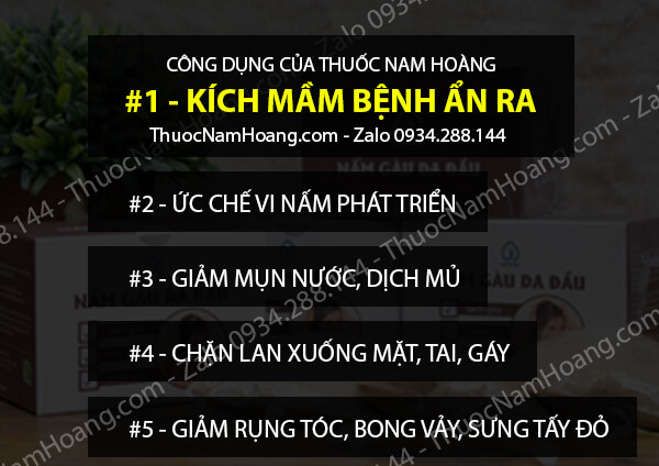 thuốc chữa gàu và rụng tóc nam hoàng