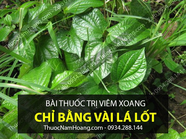 thuốc trị viêm xoang sàng