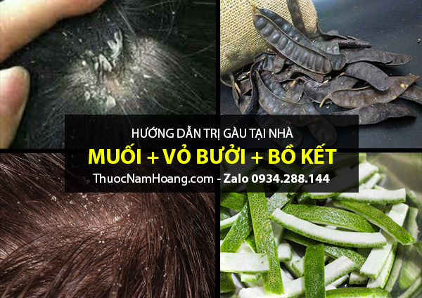 Hướng dẫn cách trị gàu bằng muối, vỏ bưởi và bồ kết tốt nhất