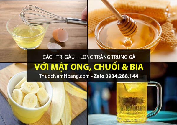 Cách hết gàu nhanh nhất bằng lòng trắng trứng gà và bia, mật ong, chuối