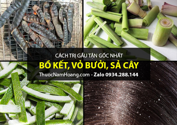 Cách trị hết gàu bằng bồ kết, vỏ bưởi và sả ngăn rụng tóc