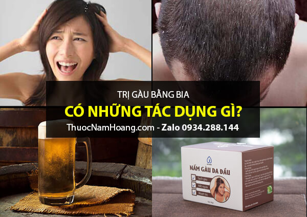 Trị gàu với bia có thật sự tốt