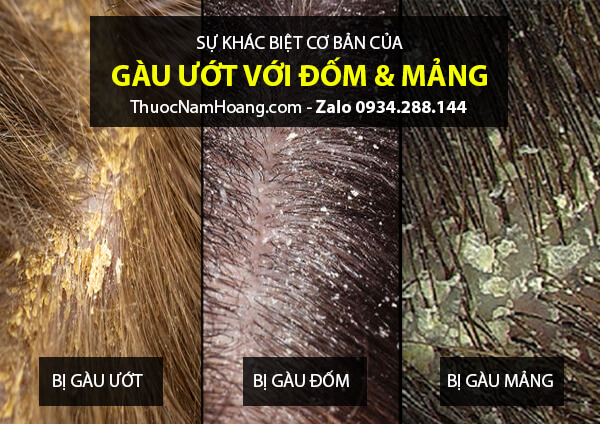 sự khác biệt của gàu ướt và gàu ống, gàu mảng