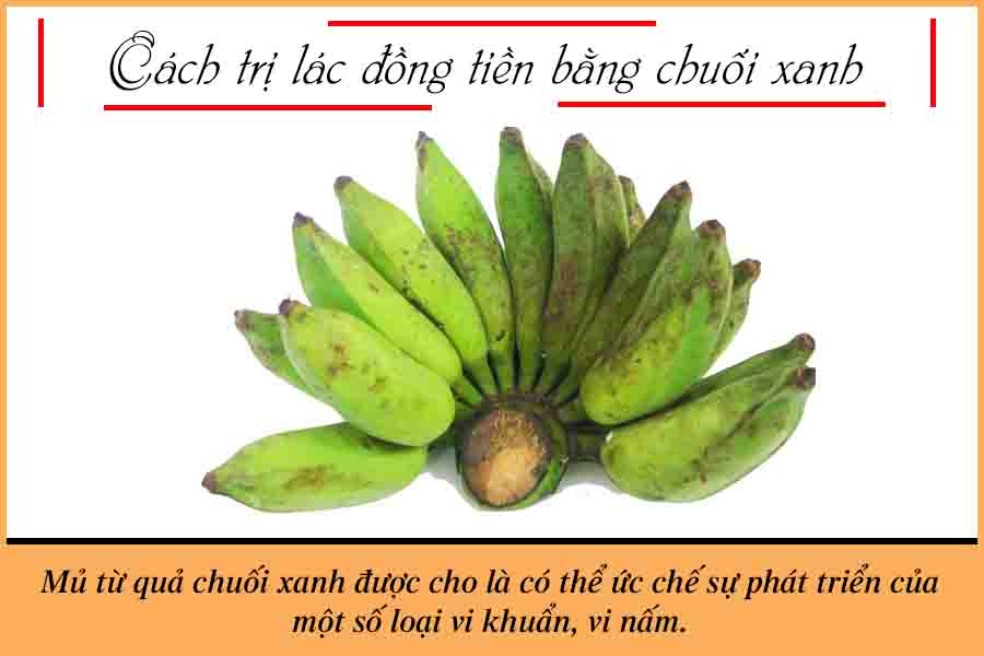 Sử dụng chuối xanh chữa lác đồng tiền