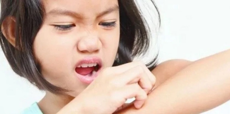 Chế độ ăn của trẻ bị lác đồng tiền