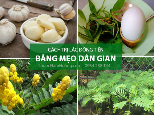 Cách trị lác đồng tiền
