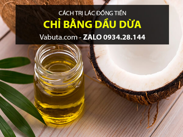 Dầu dừa trị lác đồng tiền
