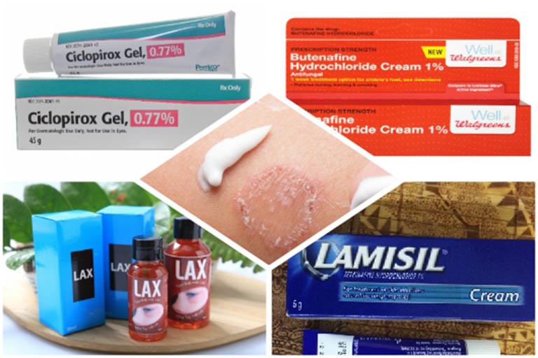 Trị lác đồng tiền ở háng bằng thuốc tây