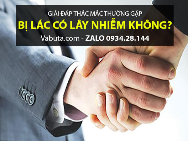 lác đồng tiền có lây không