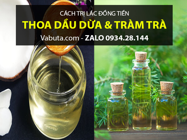 Dầu dừa trộn với tinh dầu Tràm Trà trị lác đồng tiền