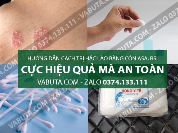 Nên dùng loại cồn gì để trị hắc lào