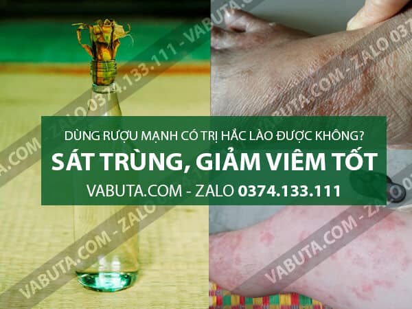 Ưu và điểm yếu khi sử dụng cồn chữa hắc lào