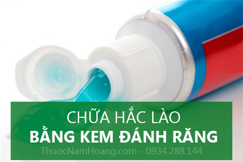 Trị hắc lào bằng kem đánh răng nguyên chất