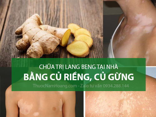 Riềng chữa lang ben