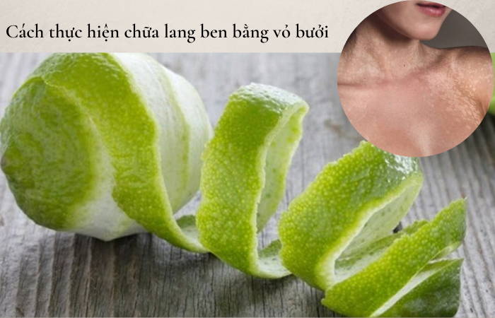 Trị lang ben tận nhà từ vỏ bưởi