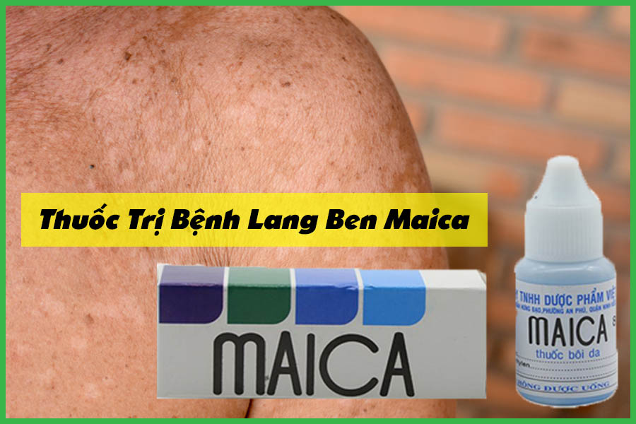 Kem bôi Maica trị lang beng