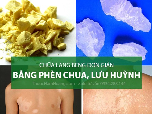 cách trị lang ben bằng phèn chua