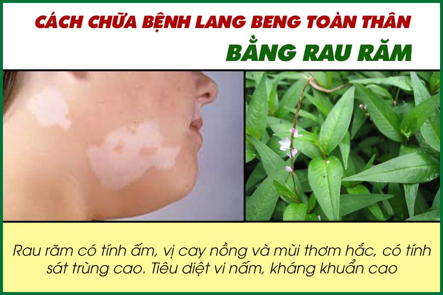 Dùng rau răm trị lang ben bao lâu thì khỏi