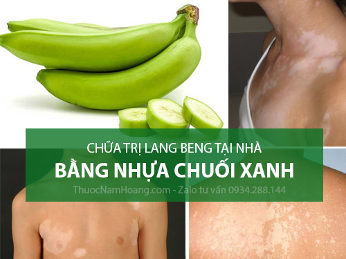 Trị lang beng bằng chuối xanh có hiệu quả không