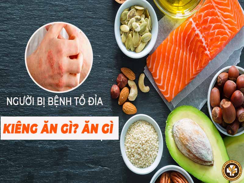 bệnh tổ đỉa kiêng ăn gì