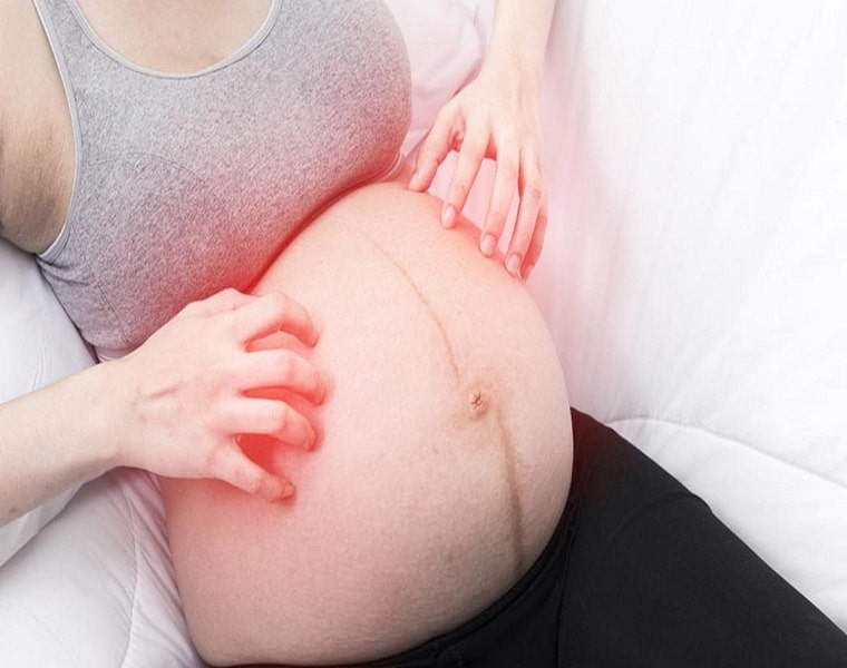 Bà bầu bị tổ đỉa có biến chứng gì?