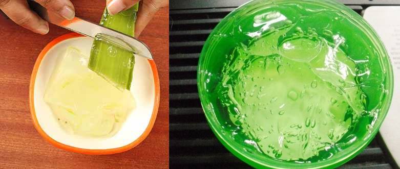Sử dụng quá gel nha đam giảm mụn nước ở chân