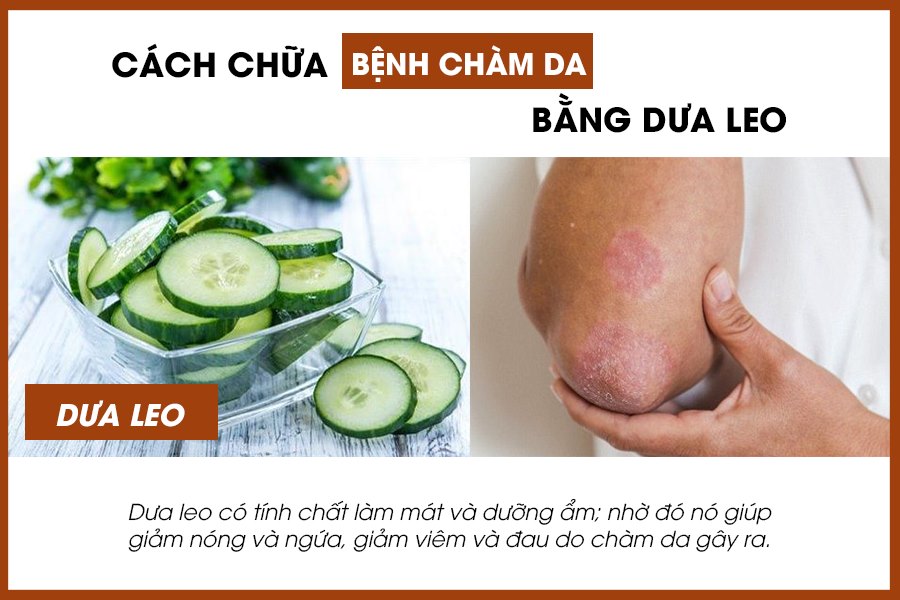 Điều trị chàm bằng dưa leo