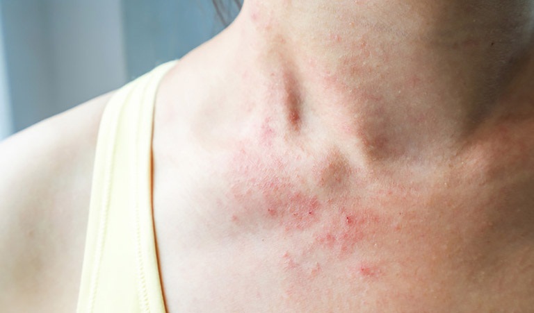 giai đoạn phát triển của chàm vi khuẩn