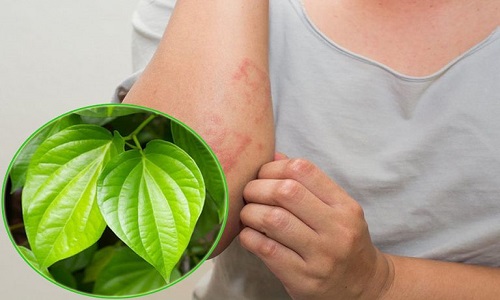 Cách trị chàm bằng lá trầu không