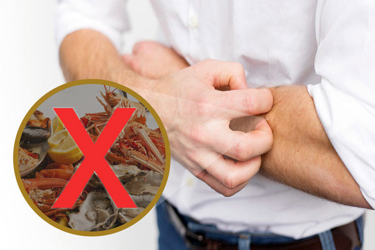 Những thức ăn phong ngứa bị chàm không nên ăn