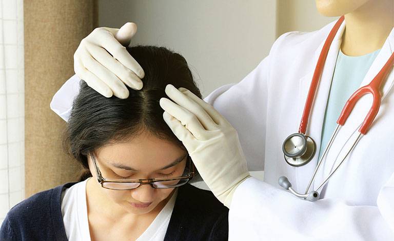 cách trị chàm da đầu