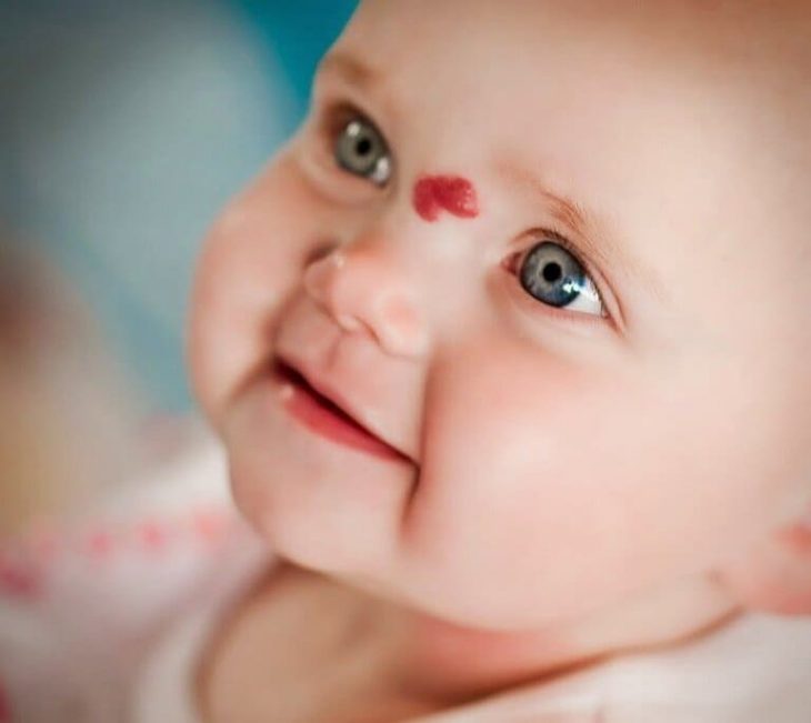 Phân biệt chàm đỏ ở trẻ với các bệnh khác
