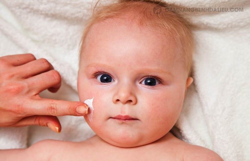 cách dân gian trị chàm sữa có thật sự hiệu quả